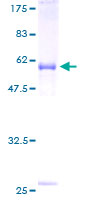 GDF15 Protein - 12.5% SDS-PAGE of human GDF15 stained with Coomassie Blue