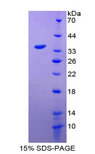 GDF15 Protein - Recombinant Growth Differentiation Factor 15 By SDS-PAGE