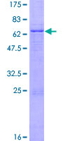 GDF3 Protein - 12.5% SDS-PAGE of human GDF3 stained with Coomassie Blue