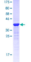 GDF5 / GDF-5 Protein - 12.5% SDS-PAGE Stained with Coomassie Blue.