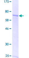 GDF9 / GDF-9 Protein - 12.5% SDS-PAGE of human GDF9 stained with Coomassie Blue