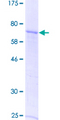 GDF9 / GDF-9 Protein - 12.5% SDS-PAGE of human GDF9 stained with Coomassie Blue