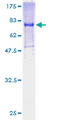 GDI1 Protein - 12.5% SDS-PAGE of human GDI1 stained with Coomassie Blue
