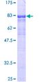 GDI1 Protein - 12.5% SDS-PAGE of human GDI1 stained with Coomassie Blue