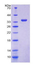 GDI1 Protein - Recombinant  GDP Dissociation Inhibitor 1 By SDS-PAGE
