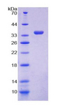 GDI1 Protein - Recombinant  GDP Dissociation Inhibitor 1 By SDS-PAGE