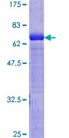 GDI2 Protein - 12.5% SDS-PAGE of human GDI2 stained with Coomassie Blue