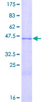 GDNF Protein - 12.5% SDS-PAGE of human GDNF stained with Coomassie Blue