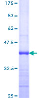 GDNF Protein - 12.5% SDS-PAGE Stained with Coomassie Blue.