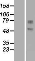 GDPD2 / GDE3 Protein - Western validation with an anti-DDK antibody * L: Control HEK293 lysate R: Over-expression lysate