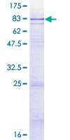 GDPD2 / GDE3 Protein - 12.5% SDS-PAGE of human GDPD2 stained with Coomassie Blue