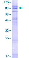 GDPD5 Protein - 12.5% SDS-PAGE of human GDPD5 stained with Coomassie Blue