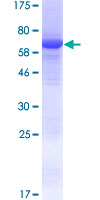 GDPGP1 / C15orf58 Protein