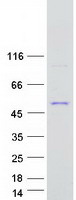 GDPGP1 / C15orf58 Protein - Purified recombinant protein GDPGP1 was analyzed by SDS-PAGE gel and Coomassie Blue Staining