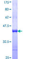 GEMIN4 Protein - 12.5% SDS-PAGE Stained with Coomassie Blue.