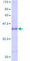 GEMIN7 Protein - 12.5% SDS-PAGE of human GEMIN7 stained with Coomassie Blue
