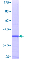 GEMIN7 Protein - 12.5% SDS-PAGE Stained with Coomassie Blue.