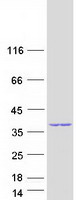 GEMIN8 Protein - Purified recombinant protein GEMIN8 was analyzed by SDS-PAGE gel and Coomassie Blue Staining