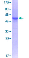 Geminin Protein - 12.5% SDS-PAGE of human GMNN stained with Coomassie Blue