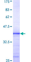 Geminin Protein - 12.5% SDS-PAGE Stained with Coomassie Blue.