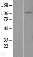 GEN1 Protein - Western validation with an anti-DDK antibody * L: Control HEK293 lysate R: Over-expression lysate