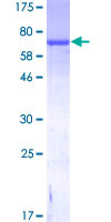 GFAP Protein - 12.5% SDS-PAGE of human GFAP stained with Coomassie Blue