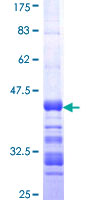 GFI1B Protein - 12.5% SDS-PAGE Stained with Coomassie Blue