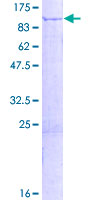 GFM1 Protein - 12.5% SDS-PAGE of human GFM1 stained with Coomassie Blue