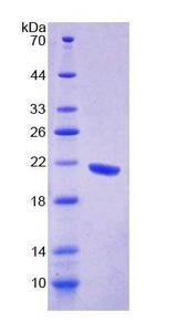 GFM1 Protein - Recombinant  G-Elongation Factor, Mitochondrial 1 By SDS-PAGE