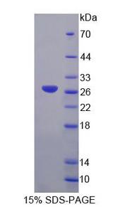 GFM2 Protein - Recombinant G-Elongation Factor, Mitochondrial 2 (GFM2) by SDS-PAGE