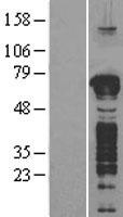 GFOD1 Protein - Western validation with an anti-DDK antibody * L: Control HEK293 lysate R: Over-expression lysate
