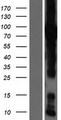 GFPT1 / GFAT Protein - Western validation with an anti-DDK antibody * L: Control HEK293 lysate R: Over-expression lysate