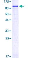 GFPT1 / GFAT Protein - 12.5% SDS-PAGE of human GFPT1 stained with Coomassie Blue