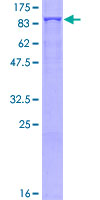 GFPT2 Protein - 12.5% SDS-PAGE of human GFPT2 stained with Coomassie Blue