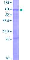 GFRA1 / GFR Alpha Protein - 12.5% SDS-PAGE of human GFRA1 stained with Coomassie Blue
