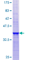 GFRA1 / GFR Alpha Protein - 12.5% SDS-PAGE Stained with Coomassie Blue.