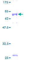 GFRA3 Protein - 12.5% SDS-PAGE of human GFRA3 stained with Coomassie Blue
