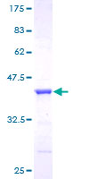 GGA1 Protein - 12.5% SDS-PAGE of human GGA1 stained with Coomassie Blue