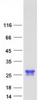 GGCT Protein - Purified recombinant protein GGCT was analyzed by SDS-PAGE gel and Coomassie Blue Staining