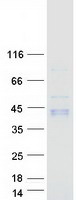 GGH / Gamma-Glutamyl Hydrolase Protein - Purified recombinant protein GGH was analyzed by SDS-PAGE gel and Coomassie Blue Staining