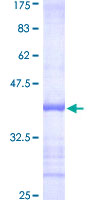 GGPS1 Protein - 12.5% SDS-PAGE Stained with Coomassie Blue.