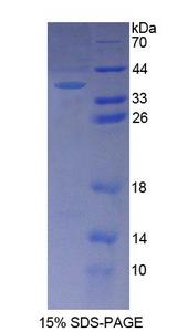 GGPS1 Protein - Recombinant  Geranylgeranyl Diphosphate Synthase 1 By SDS-PAGE