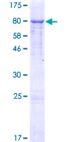 GGT1 / GGT Protein - 12.5% SDS-PAGE of human GGT1 stained with Coomassie Blue