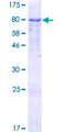 GGT1 / GGT Protein - 12.5% SDS-PAGE of human GGT1 stained with Coomassie Blue