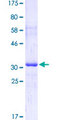 GGT1 / GGT Protein - 12.5% SDS-PAGE Stained with Coomassie Blue.