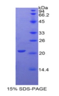 GGT1 / GGT Protein - Recombinant Gamma-Glutamyltransferase 1 By SDS-PAGE