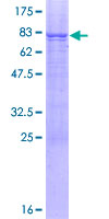 GGT6 Protein - 12.5% SDS-PAGE of human GGT6 stained with Coomassie Blue