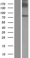 GGT7 Protein - Western validation with an anti-DDK antibody * L: Control HEK293 lysate R: Over-expression lysate