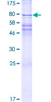 GGTLA1 / GGT5 Protein - 12.5% SDS-PAGE of human GGTLA1 stained with Coomassie Blue