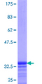 GGTLA1 / GGT5 Protein - 12.5% SDS-PAGE Stained with Coomassie Blue.